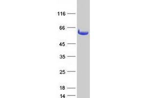 DDX19A Protein (Myc-DYKDDDDK Tag)