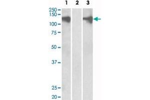 HEK293 lysate (10 ug protein in RIPA buffer) overexpressing human PUM2 with DYKDDDDK tag probed with PUM2 polyclonal antibody  (0. (PUM2 antibody  (Internal Region))