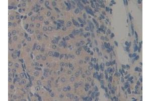 Immunohistochemistry (IHC) image for anti-Regenerating Islet-Derived 3 beta (REG3B) (AA 27-175) antibody (ABIN7441622)