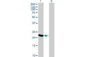 Western Blot analysis of ARL3 expression in transfected 293T cell line by ARL3 MaxPab polyclonal antibody. (ARL3 antibody  (AA 1-182))