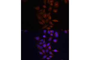 Immunofluorescence (IF) image for anti-Presenilin 1 (PSEN1) (AA 1-160) antibody (ABIN3023160)
