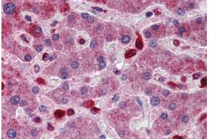 Human Liver: Formalin-Fixed, Paraffin-Embedded (FFPE) (ACP2 antibody  (AA 144-193))