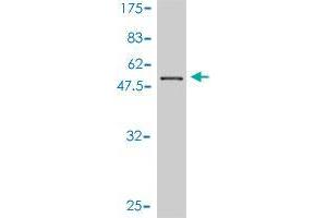 Western Blot detection against Immunogen (48. (CENPN antibody  (AA 1-204))