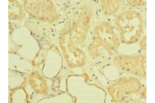 ST6GALNAC6 antibody  (AA 65-333)