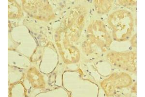 Immunohistochemistry of paraffin-embedded human kidney tissue using ABIN7143923 at dilution of 1:100 (ST6GALNAC6 antibody  (AA 65-333))