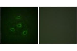 Immunofluorescence analysis of HepG2 cells, using PP2A-alpha (Ab-307) Antibody. (PPP2CA antibody  (AA 260-309))