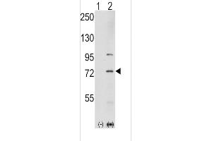 Western blot analysis of K1 (arrow) using rabbit polyclonal K1 Antibody  (ABIN392432 and ABIN2842032). (PAK1 antibody  (AA 401-430))