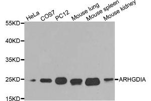 Western blot analysis of extracts of various cell lines, using ARHGDIA antibody (ABIN5970556) at 1/1000 dilution. (ARHGDIA antibody)