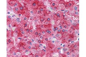 ApoE antibody was used for immunohistochemistry at a concentration of 4-8 ug/ml. (APOE antibody  (N-Term))