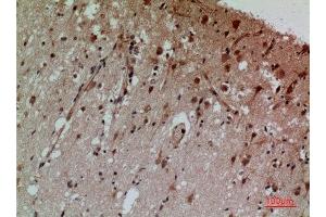 Immunohistochemistry (IHC) analysis of paraffin-embedded Human Brain, antibody was diluted at 1:100. (CD58 antibody  (Internal Region))