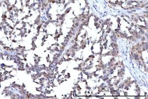 IHC analysis of RANBP2 using anti-RANBP2 antibody (ABIN7602650). (RANBP2 antibody  (AA 906-2744))