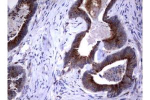 Image no. 1 for anti-Sialidase 1 (Lysosomal Sialidase) (NEU1) (AA 48-315) antibody (ABIN1491548) (NEU1 antibody  (AA 48-315))