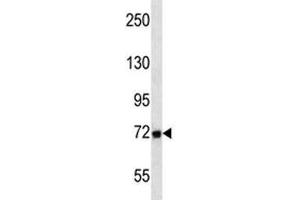 MMP2 antibody western blot analysis in T47D lysate. (MMP2 antibody  (AA 303-331))