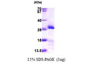 SDS-PAGE (SDS) image for Transcription Factor A, Mitochondrial (TFAM) (AA 43-246) protein (His tag) (ABIN7279315) (TFAM Protein (AA 43-246) (His tag))