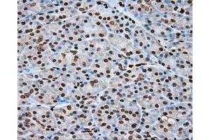 Immunohistochemical staining of paraffin-embedded lung tissue using anti-DAPK2 mouse monoclonal antibody. (DAPK2 antibody)