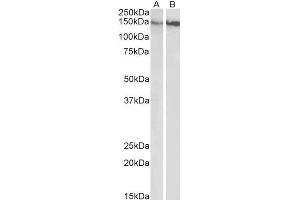 ABIN5539624 (0. (ITGB1 antibody  (Internal Region))