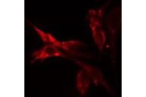ABIN6275501 staining HeLa cells by IF/ICC. (ARHGEF2 antibody  (C-Term))