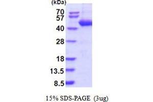 SDS-PAGE (SDS) image for serpin Peptidase Inhibitor, Clade B (Ovalbumin), Member 4 (SERPINB4) (AA 1-390) protein (His tag) (ABIN5854190)