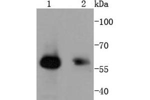 Lane 1: Human skeletal muscle, Lane 2: Hela, probed with HDAC2 (3B7) Monoclonal Antibody  at 1:1000 overnight at 4˚C. (SMAD1 antibody)