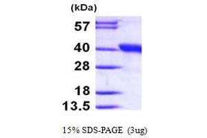 Dimethylarginine Dimethylaminohydrolase 1 (DDAH1) (AA 1-285) protein (His tag)