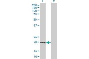 Western Blot analysis of RBP4 expression in transfected 293T cell line by RBP4 MaxPab polyclonal antibody. (RBP4 antibody  (AA 1-201))