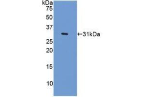 Western blot analysis of recombinant Human CENPI. (CENPI antibody  (AA 292-528))