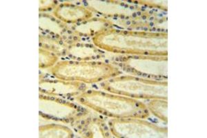 Immunohistochemistry analysis in formalin fixed and paraffin embedded lung tissue reacted with 17-beta-HSD11 / HSD17B11 Antibody (N-term) followed which was peroxidase conjugated to the secondary antibody and followed by DAB staining. (HSD17B11 antibody  (N-Term))