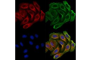 ABIN7094247 and ABIN7098294 staining Hela cells by IF/ICC.