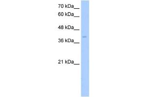 ZDHHC17 antibody used at 5 ug/ml to detect target protein. (ZDHHC17 antibody  (Middle Region))