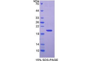 Image no. 1 for Superoxide Dismutase 1, Soluble (SOD1) (AA 2-154) protein (His tag) (ABIN6238004) (SOD1 Protein (AA 2-154) (His tag))
