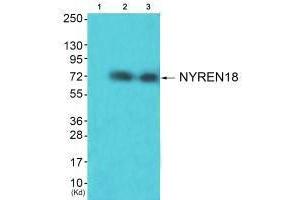 Western blot analysis of extracts from HuvEc cells (Lane 2) and JK cells (Lane 3), using NYREN18 antiobdy. (NUB1 antibody  (C-Term))