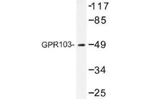 Image no. 1 for anti-Pyroglutamylated RFamide Peptide Receptor (QRFPR) antibody (ABIN317864) (QRFPR antibody)