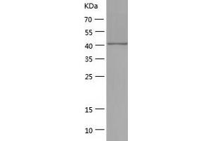 Western Blotting (WB) image for phosphoribosylaminoimidazole Carboxylase, phosphoribosylaminoimidazole Succinocarboxamide Synthetase (PAICS) (AA 1-425) protein (His tag) (ABIN7285666) (PAICS Protein (AA 1-425) (His tag))