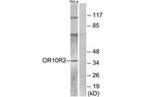Western blot analysis of extracts from HeLa cells, using OR10R2 Antibody. (OR10R2 antibody  (AA 286-335))