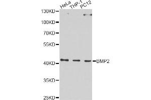Western blot analysis of extracts of various cell lines, using BMP2 Antibody. (BMP2 antibody)