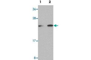 Western blot analysis of Raji cells with LIN28 polyclonal antibody  at (Lane 1) 1 and (Lane 2) 2 ug/mL dilution. (LIN28A antibody  (C-Term))