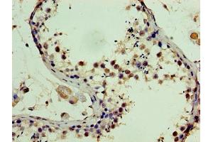 Immunohistochemistry of paraffin-embedded human testis tissue using ABIN7169765 at dilution of 1:100 (SSSCA1 antibody  (AA 2-199))