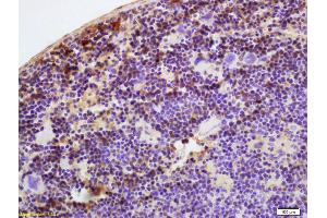 Formalin-fixed and paraffin embedded mouse spleen labeled with Anti-ATH III/Antithrombin III Polyclonal Antibody, Unconjugated (ABIN732323) at 1:200 followed by conjugation to the secondary antibody and DAB staining
