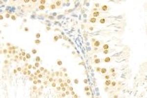 Immunohistochemistry analysis of paraffin-embedded rat testis using mSin3A (ABIN7075609) at dilution of 1: 100 (SIN3A antibody)