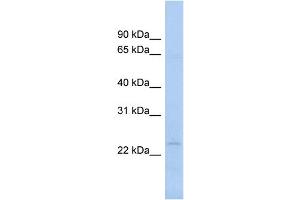 WB Suggested Anti-NAT9 Antibody Titration:  0. (NAT9 antibody  (N-Term))