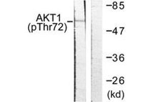 Western blot analysis of extracts from NIH-3T3 cells treated with TNF-a 20ng/ml 30', using Akt (Phospho-Thr72) Antibody. (AKT1 antibody  (pThr72))