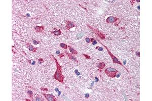 Anti-KCNH2 / Kv11. (KCNH2 antibody  (Internal Region))