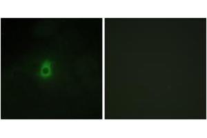 Immunofluorescence analysis of HepG2 cells, using Cytochrome P450 2E1 Antibody. (CYP2E1 antibody  (AA 371-420))