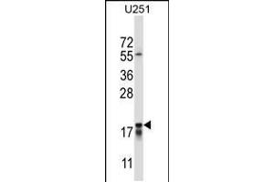 Western blot analysis in U251 cell line lysates (35ug/lane). (CTAG2 antibody  (AA 122-149))