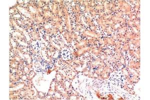 Immunohistochemical analysis of paraffin-embedded Mouse Kidney Tissue using Bax Mouse mAb diluted at 1:200.