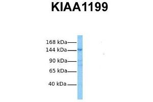Host:  Rabbit  Target Name:  KIAA1199  Sample Tissue:  Human OVCAR-3  Antibody Dilution:  1. (CEMIP antibody  (Middle Region))