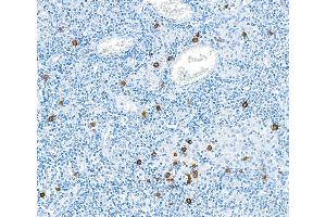 Immunohistochemistry (IHC) image for anti-Granzyme B (GZMB) (AA 19-247) antibody (ABIN7449554)