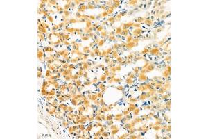 Immunohistochemistry of paraffin embedded rat gastritis using GRASP (ABIN7074140) at dilution of 1:400 (400x lens) (Tamalin/GRASP antibody)