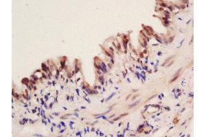 Formalin-fixed and paraffin embedded mouse lung labeled with Rabbit Anti-Fox2/RBM9 Polyclonal Antibody, Unconjugated  at 1:200 followed by conjugation to the secondary antibody and DAB staining (RBM9 antibody  (AA 65-170))