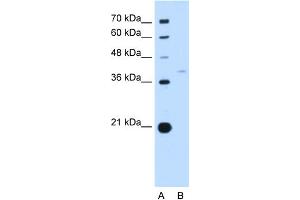 WB Suggested Anti-RFC3 Antibody Titration:  0.
